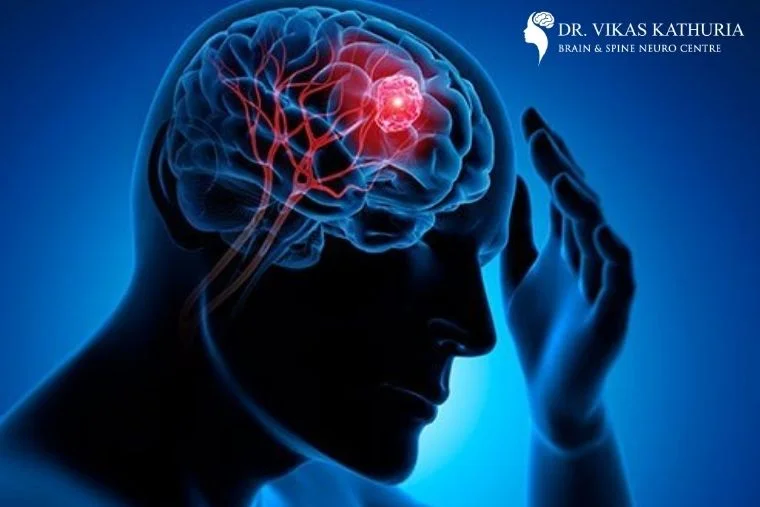 Brain Hemorrhage Clinic in Gurgaon