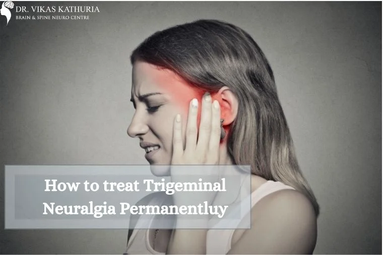 How do you permanently treat Trigeminal Neuralgia