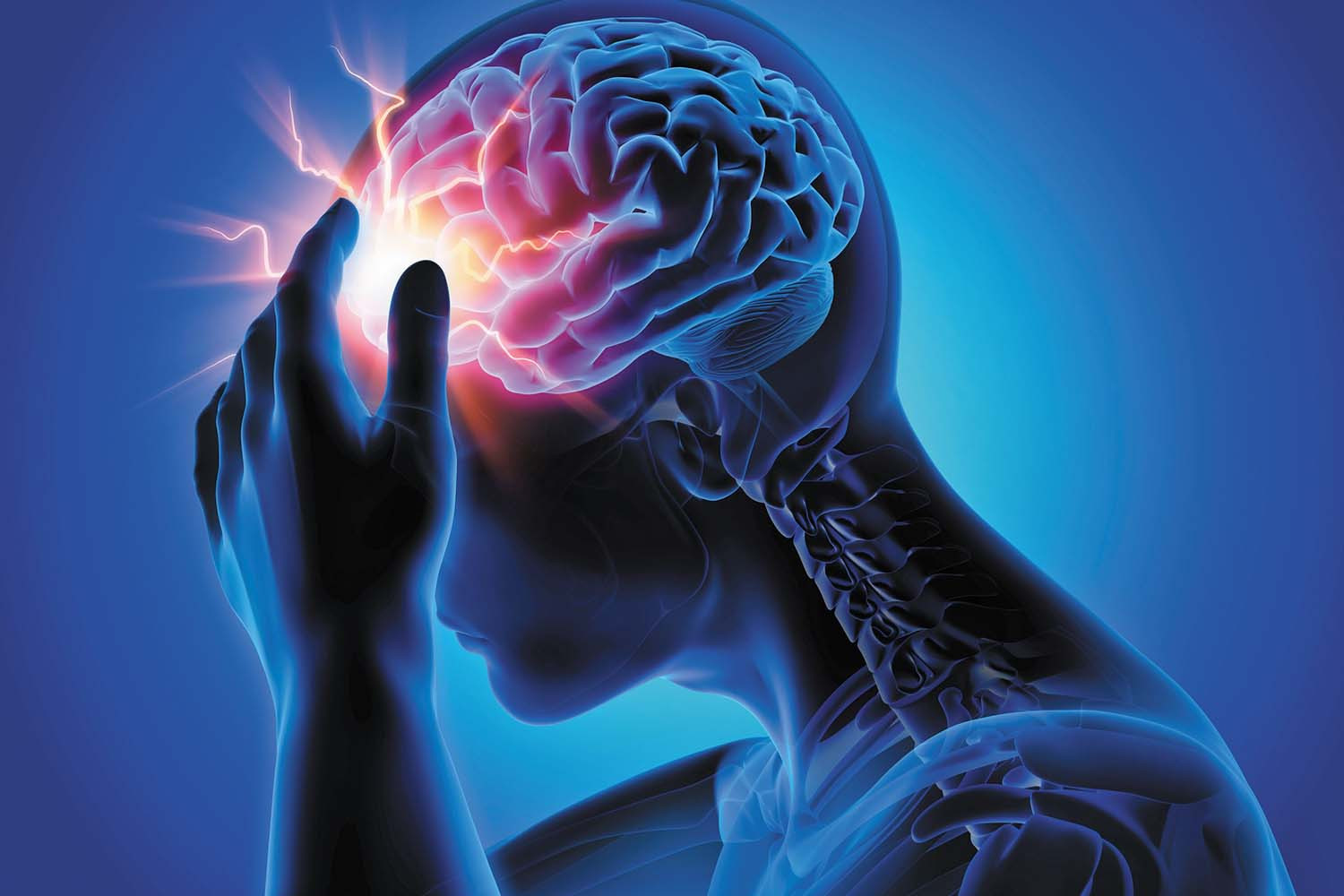 What happens to the brain during a Migraine