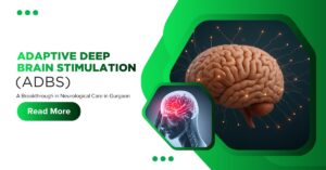 Adaptive Deep Brain Stimulation (aDBS): A Revolutionary Advancement in Neurology by Dr. Vikas Kathuria in Gurgaon